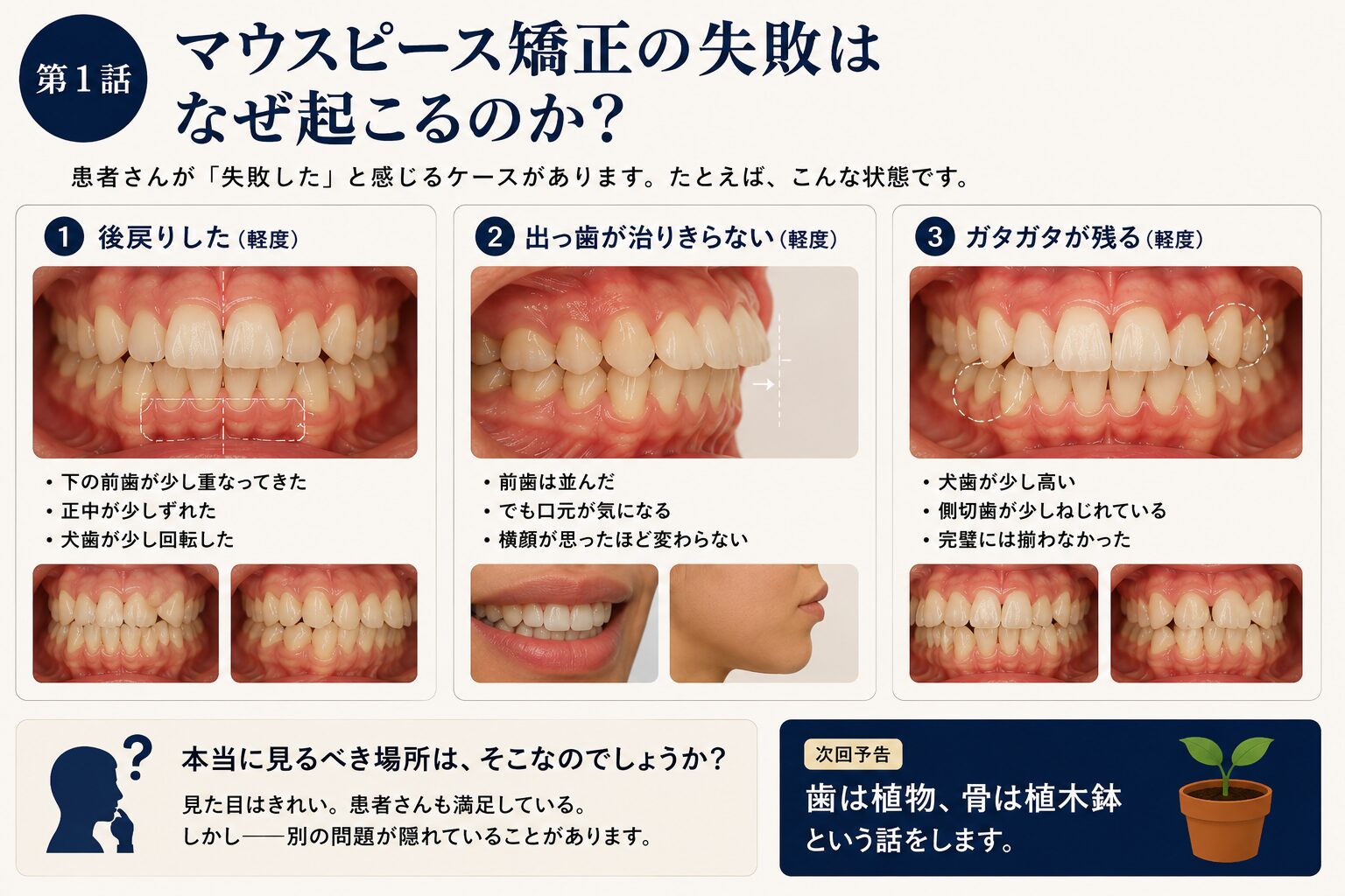 マウス ピース 矯正 失敗