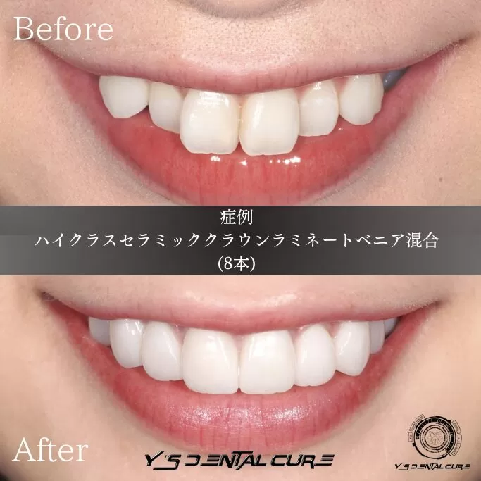 今、綺麗になるということ