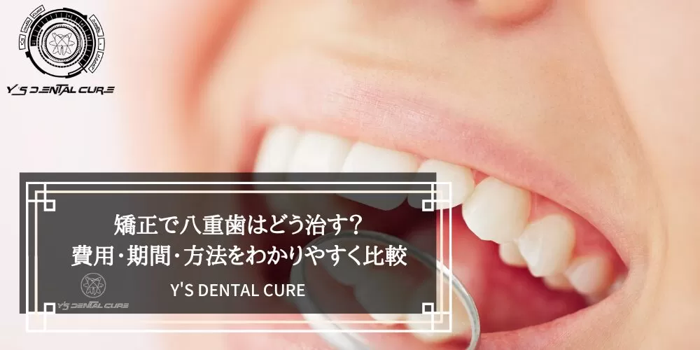 矯正で八重歯はどう治す?費用・期間・方法をわかりやすく比較