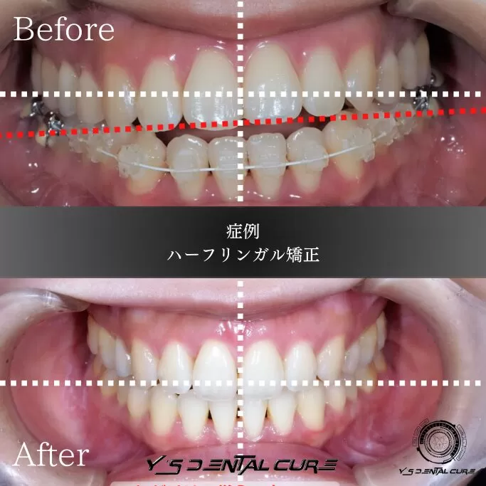 美人から、モア美人へ