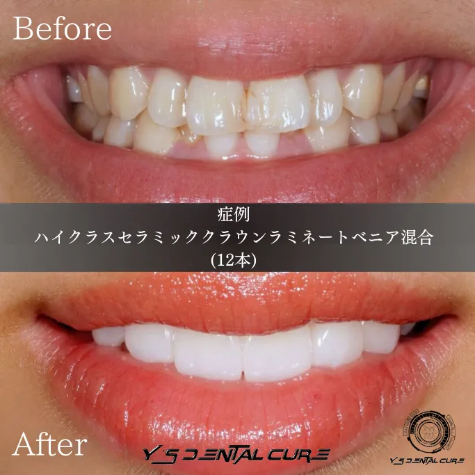 花嫁の自信に満ちた笑顔