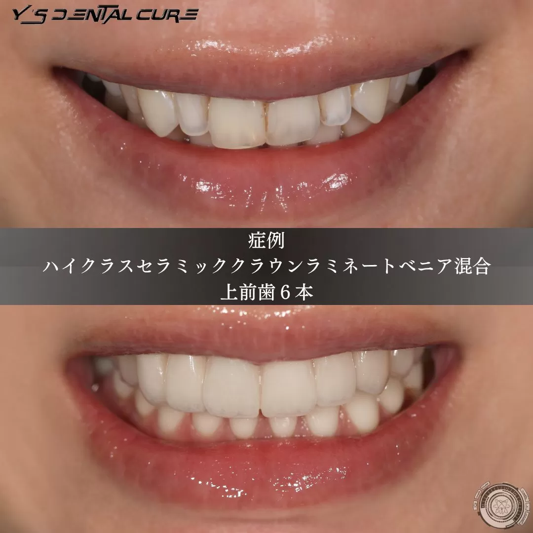 更なる自然観を目指して!顔と歯の平面正中を大事にしています