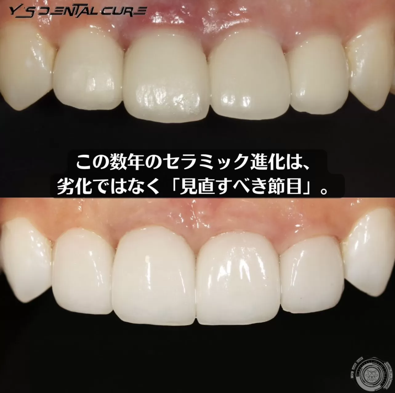 この数年のセラミック進化は劣化ではなく「見直すべき節目」