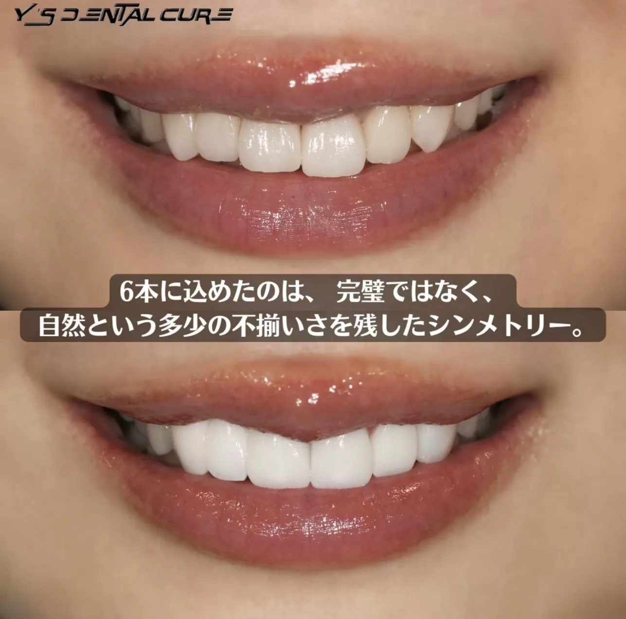 自然という多少の不揃いさを残したシンメトリー