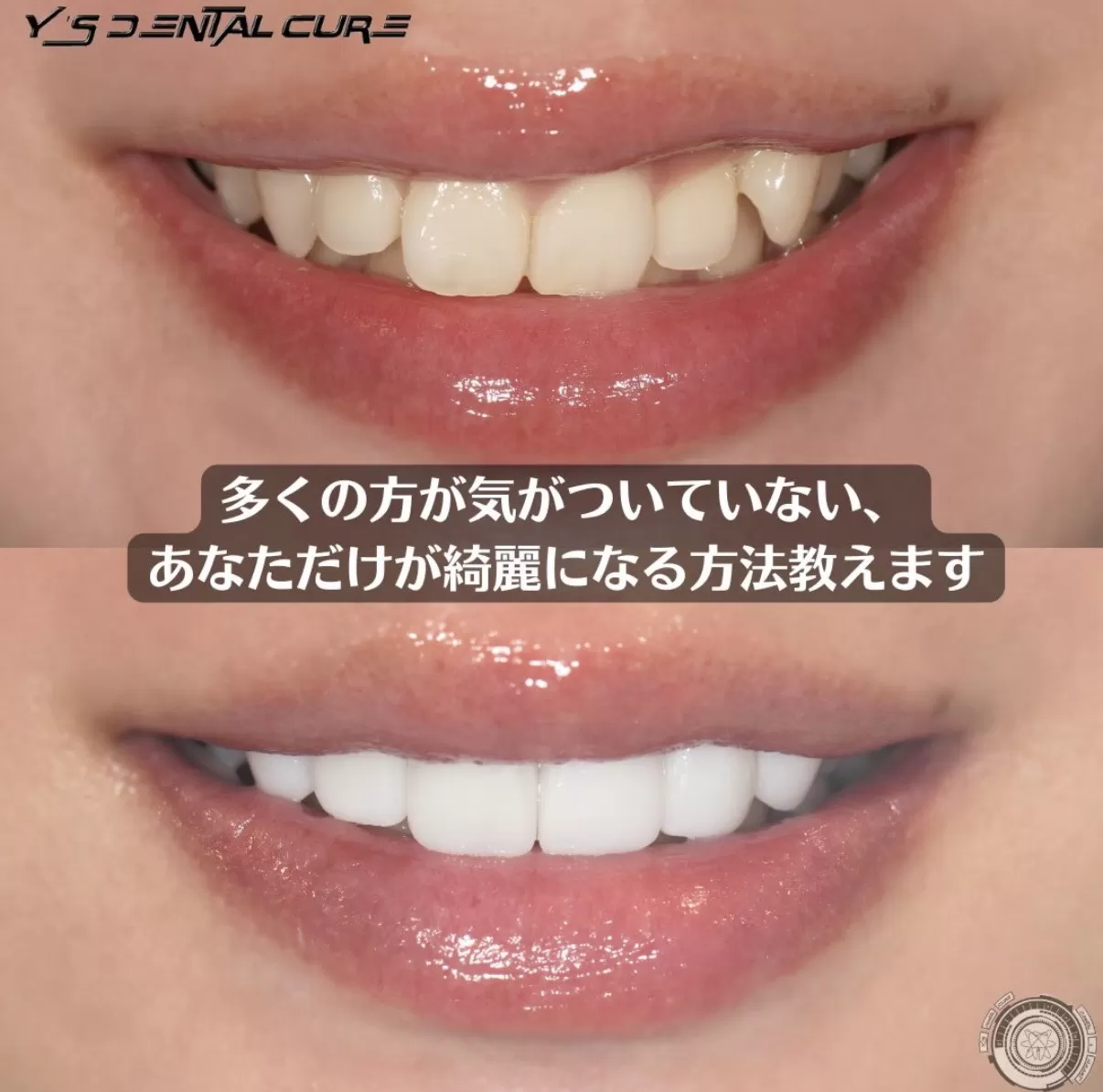 多くの方が気づいていない、あなただけが綺麗になる方法教えます