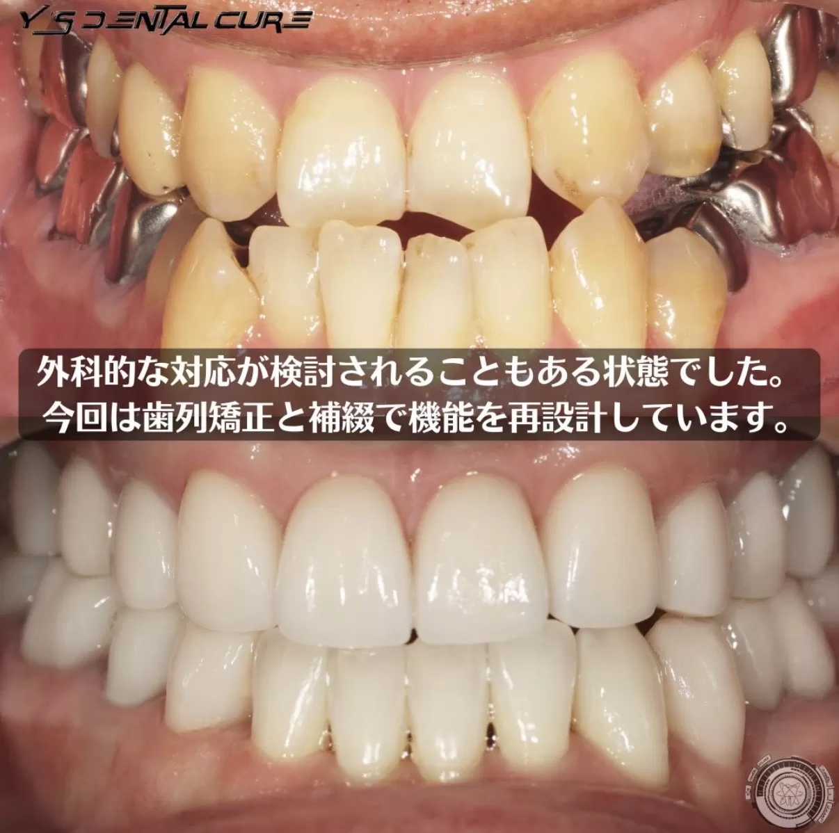 外科的な対応が検討されることもある状態でした。