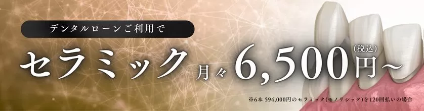 セラミック月々6,500円～