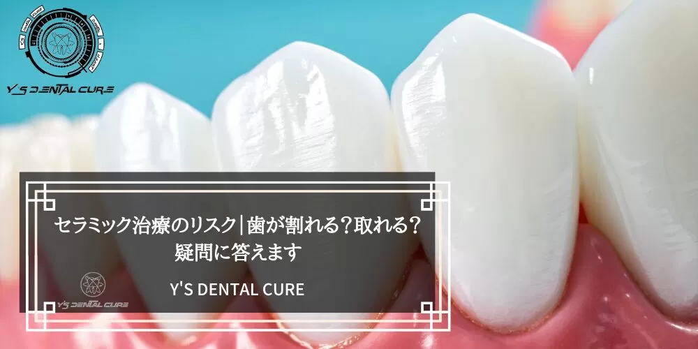 セラミック治療のリスク|歯が割れる?取れる?疑問に答えます