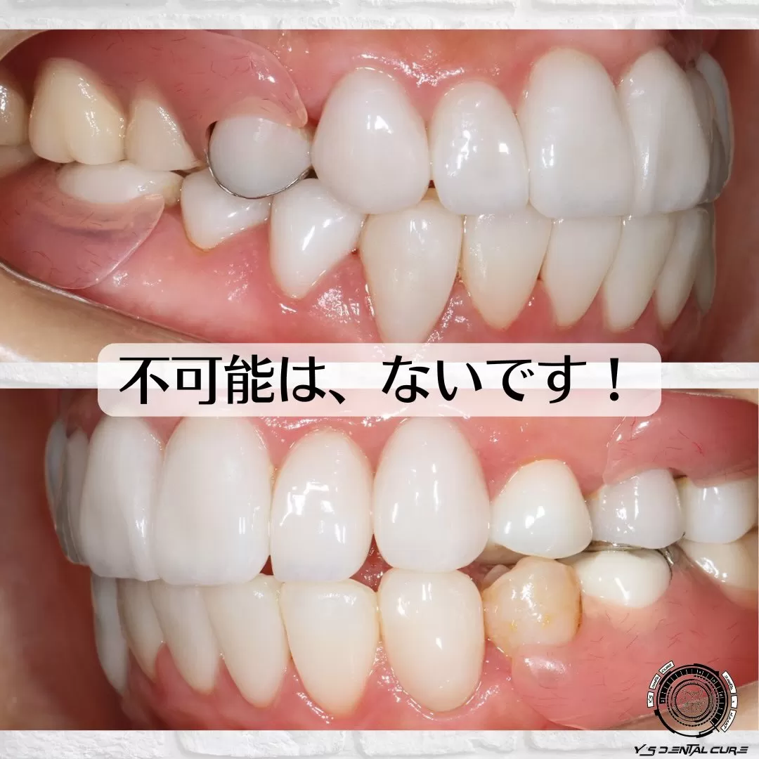 不可能は、ないです!