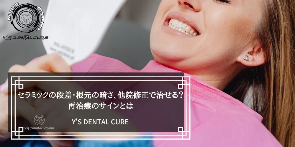 セラミックの段差・根元の暗さ、他院修正で治せる?再治療のサインとは