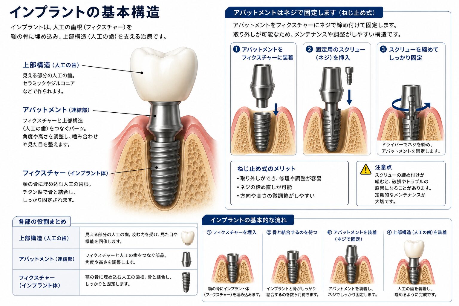 インプラントのヤバいとこ | 医療法人社団デンタルキュア ワイズ
