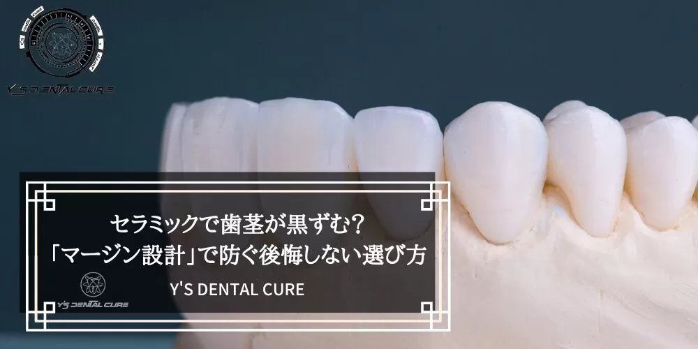 セラミックで歯茎が黒ずむ?「マージン設計」で防ぐ後悔しない選び方
