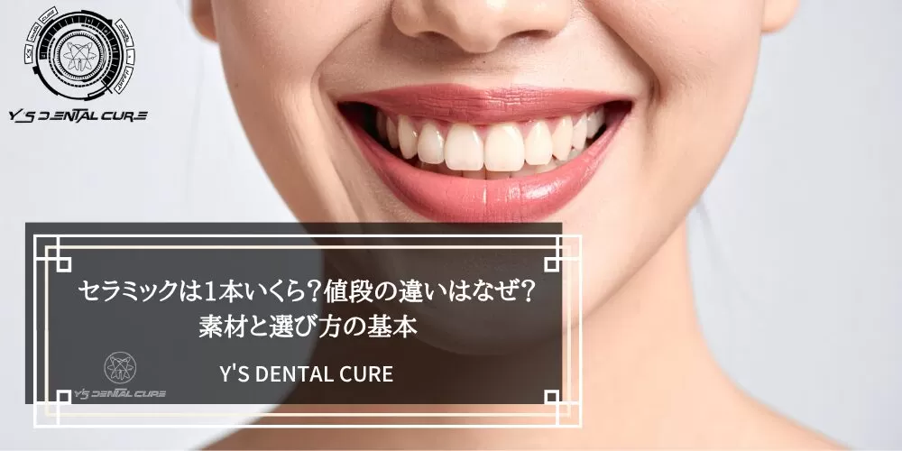 セラミックは1本いくら?値段の違いはなぜ?素材と選び方の基本