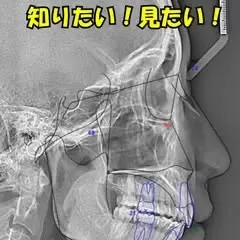 矯正する前に知りたい！見たい！