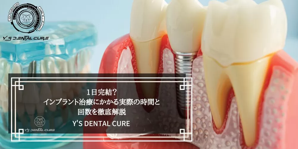 1日完結？インプラント治療にかかる実際の時間と回数を徹底解説