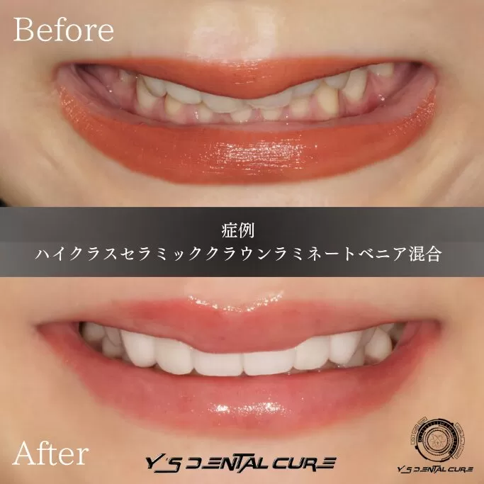 モナ・リザのような理想の口元になるには?