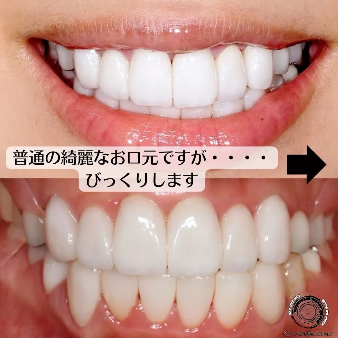 普通の綺麗な口元ですが…びっくりします