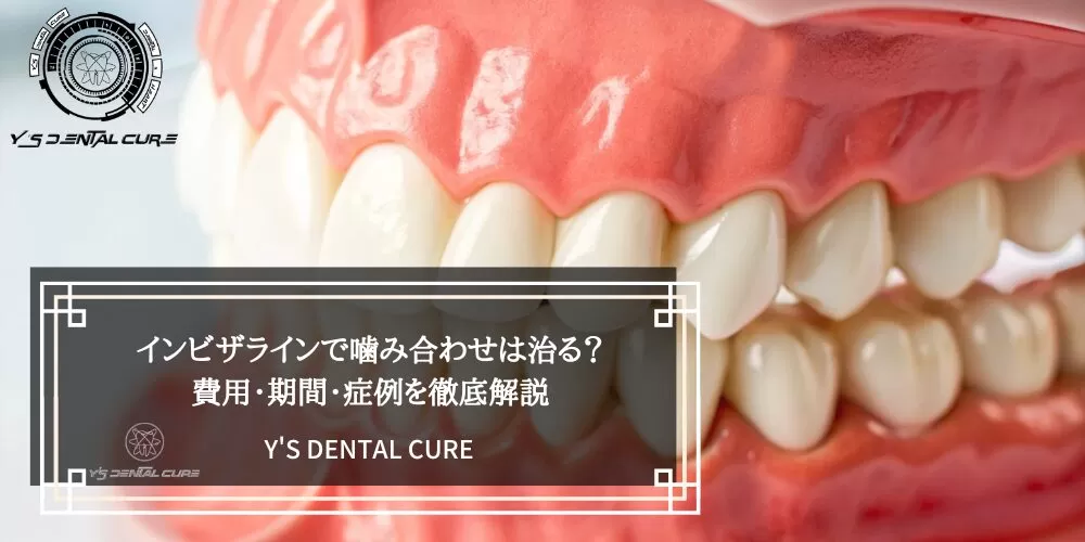 インビザラインで噛み合わせは治る？
費用・期間・症例を徹底解説