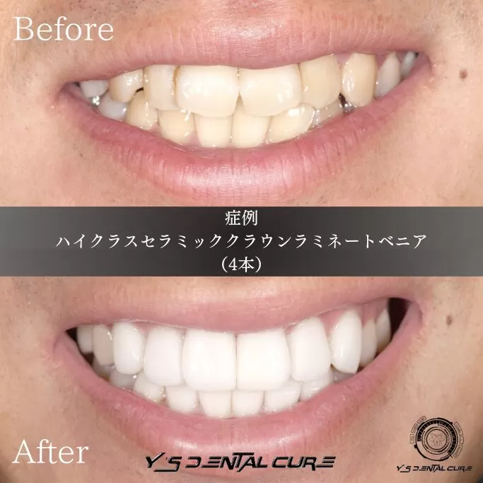 口元の歪みも改善、物理的な笑顔をつくりやすくする。