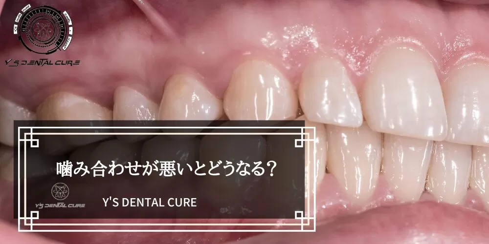 噛み合わせが悪いとどうなる？