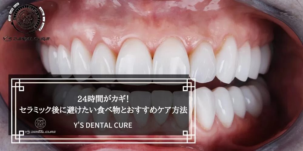 24時間がカギ！セラミック後に避けたい食べ物とおすすめケア方法