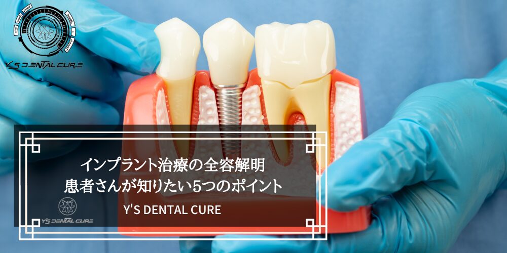 暫間ミニインプラント療法 : 臨床を変える新次元の包括的治療法　歯科　本 暫間ミニインプラント療法 : 臨床を変える新次元の包括的治療法 歯科