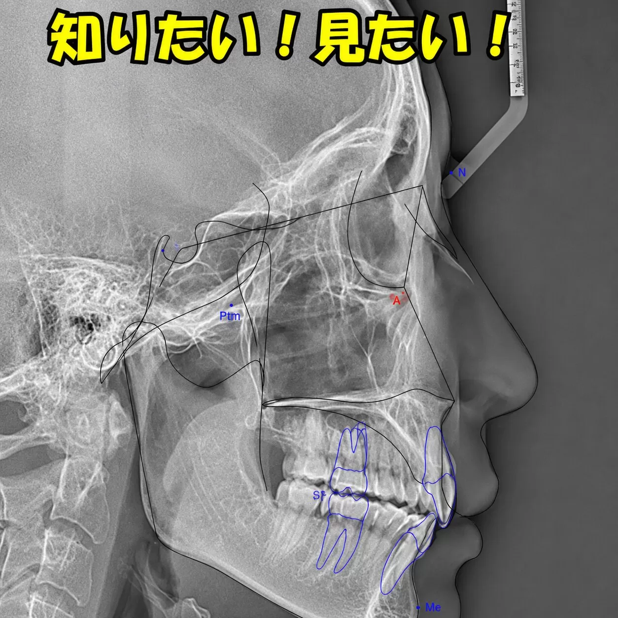 矯正する前に知りたい！見たい！